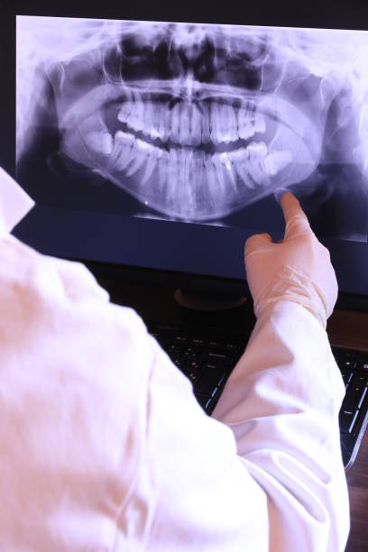 Urgent Tooth Repair in GA